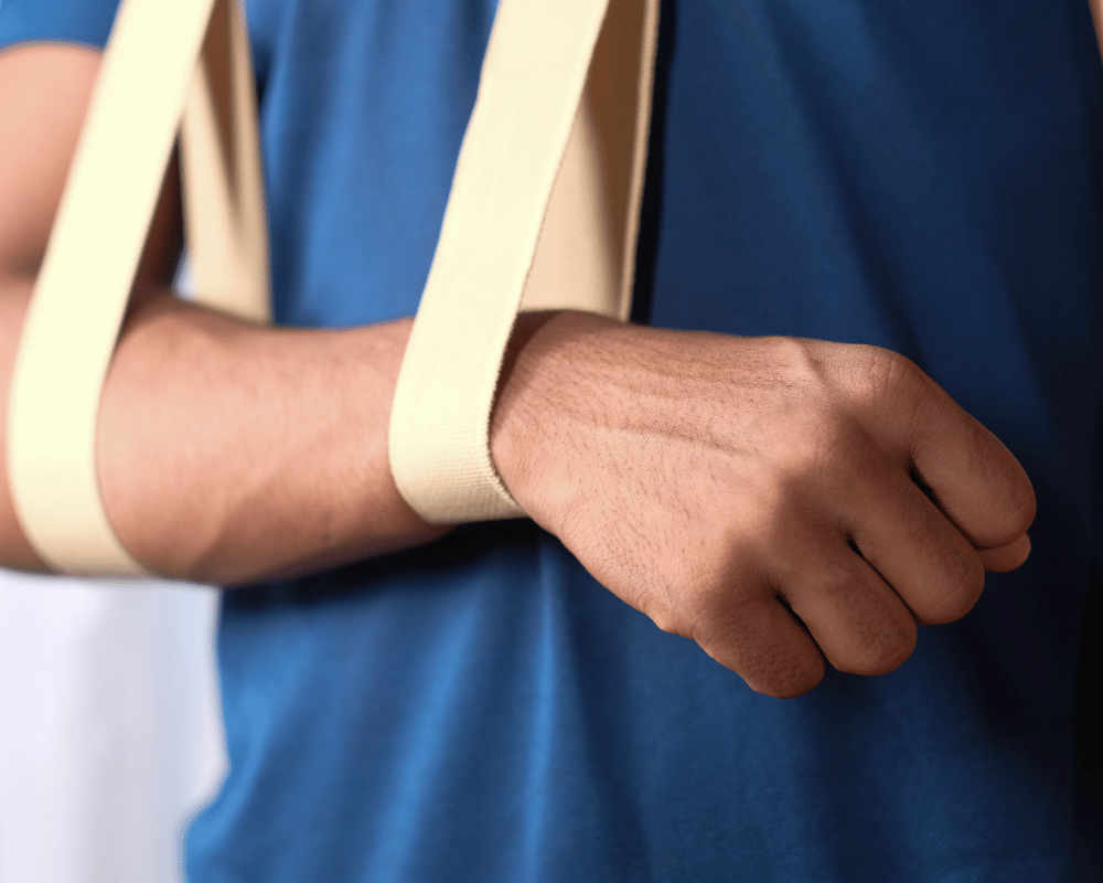 Broken arm